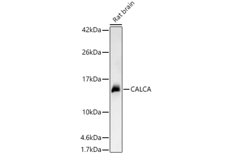 Western Blot - Anti-CGRP-1 Antibody (A91943) - Antibodies.com