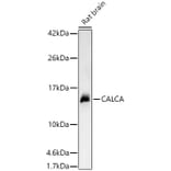 Western Blot - Anti-CGRP-1 Antibody (A91943) - Antibodies.com