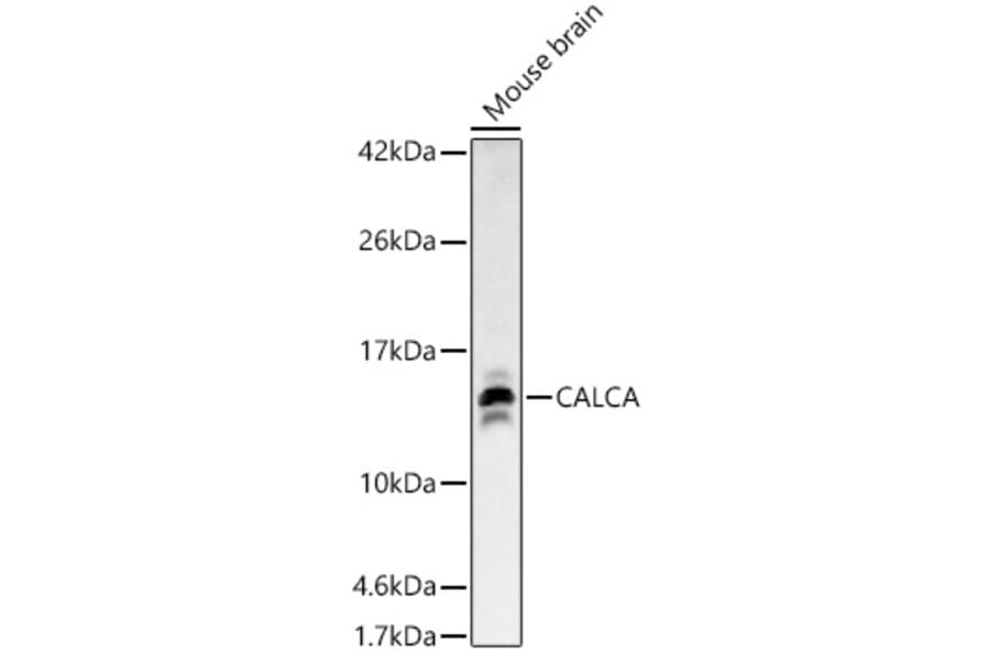 Western Blot - Anti-CGRP-1 Antibody (A91943) - Antibodies.com