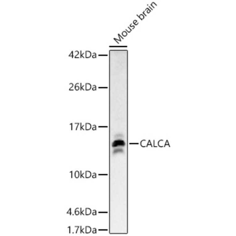 Western Blot - Anti-CGRP-1 Antibody (A91943) - Antibodies.com