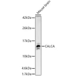 Western Blot - Anti-CGRP-1 Antibody (A91943) - Antibodies.com