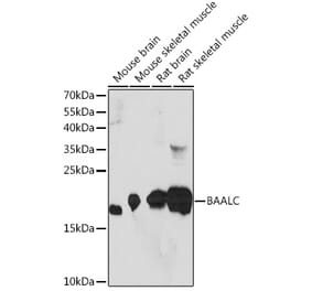 Western Blot - Anti-BAALC Antibody (A91944) - Antibodies.com