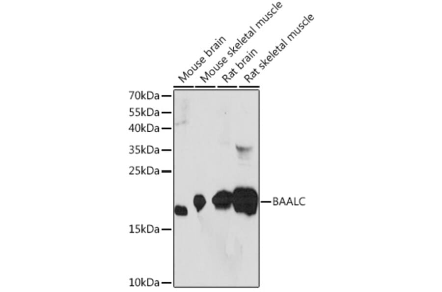 Western Blot - Anti-BAALC Antibody (A91944) - Antibodies.com