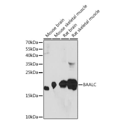 Western Blot - Anti-BAALC Antibody (A91944) - Antibodies.com