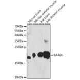 Western Blot - Anti-BAALC Antibody (A91944) - Antibodies.com