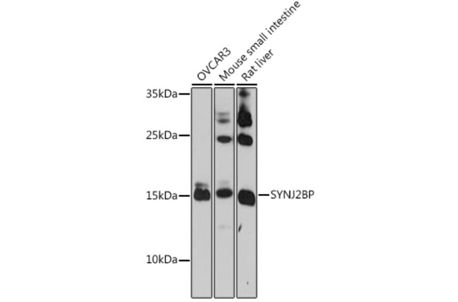 Western Blot - Anti-SYNJ2BP Antibody (A91945) - Antibodies.com