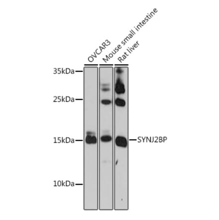 Western Blot - Anti-SYNJ2BP Antibody (A91945) - Antibodies.com