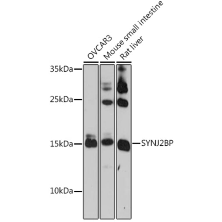 Western Blot - Anti-SYNJ2BP Antibody (A91945) - Antibodies.com