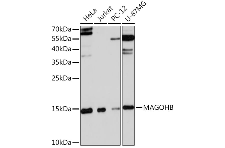 Western Blot - Anti-Mago nashi homolog 2 Antibody (A91946) - Antibodies.com