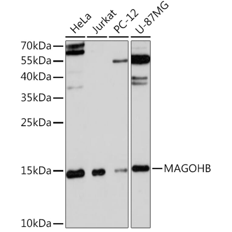 Western Blot - Anti-Mago nashi homolog 2 Antibody (A91946) - Antibodies.com