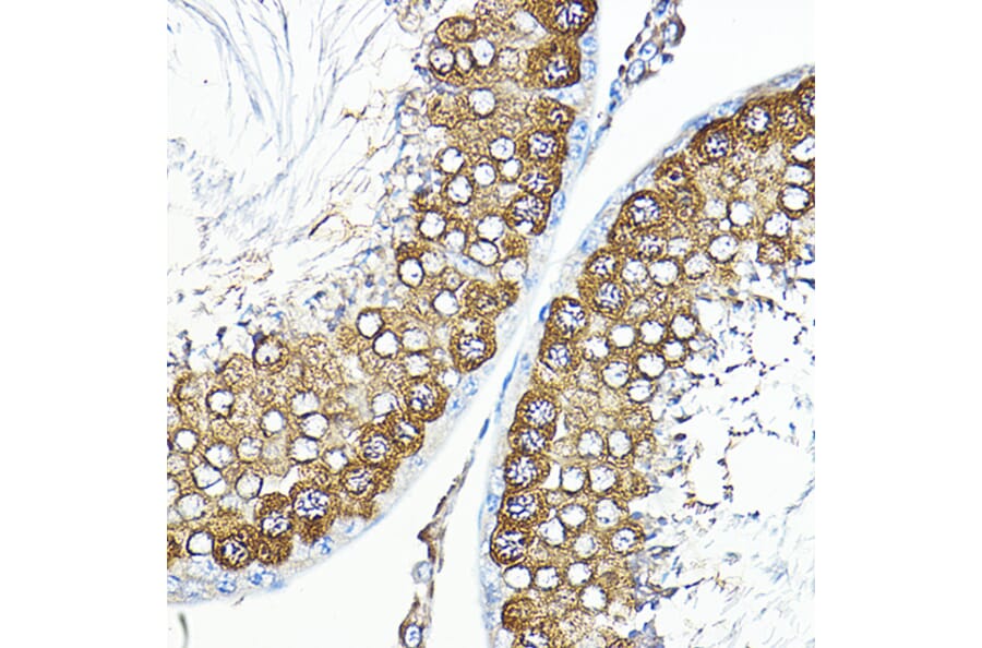 Immunohistochemistry - Anti-Calmodulin 1 + Calmodulin 2 + Calmodulin 3 Antibody (A91947) - Antibodies.com
