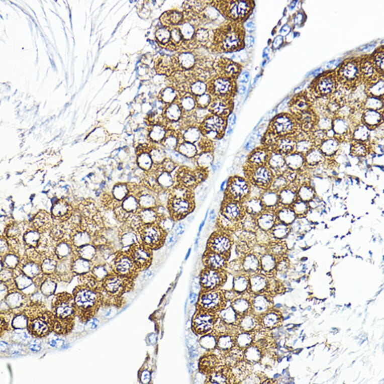 Immunohistochemistry - Anti-Calmodulin 1 + Calmodulin 2 + Calmodulin 3 Antibody (A91947) - Antibodies.com