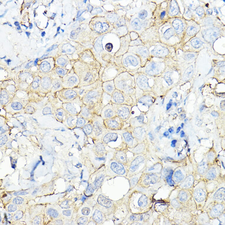 Immunohistochemistry - Anti-Calmodulin 1 + Calmodulin 2 + Calmodulin 3 Antibody (A91947) - Antibodies.com