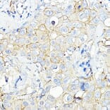 Immunohistochemistry - Anti-Calmodulin 1 + Calmodulin 2 + Calmodulin 3 Antibody (A91947) - Antibodies.com