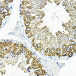 Immunohistochemistry - Anti-Calmodulin 1 + Calmodulin 2 + Calmodulin 3 Antibody (A91947) - Antibodies.com