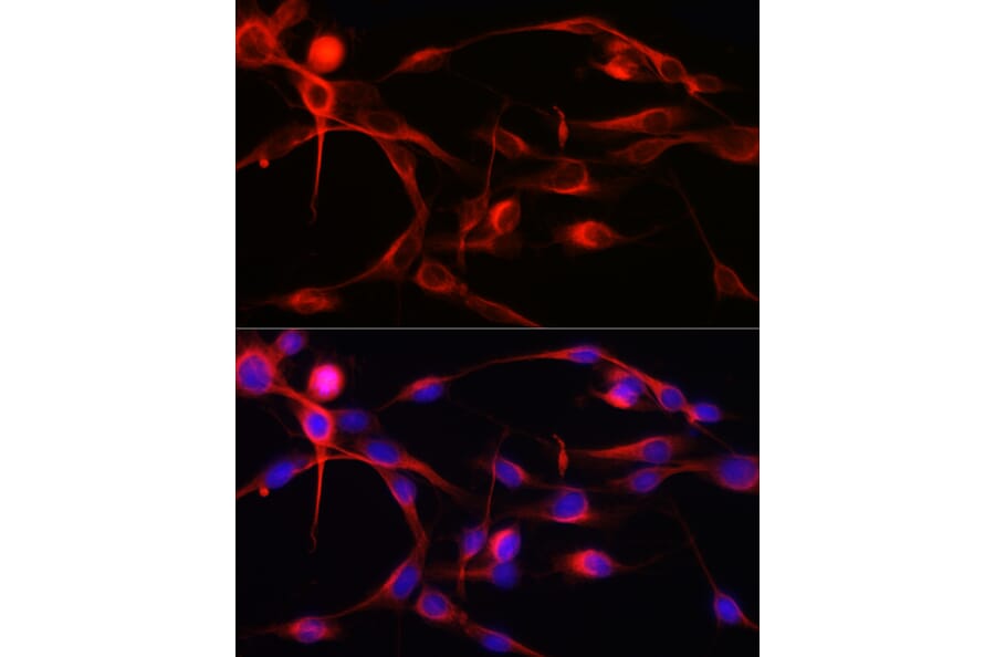 Immunofluorescence - Anti-Calmodulin 1 + Calmodulin 2 + Calmodulin 3 Antibody (A91947) - Antibodies.com