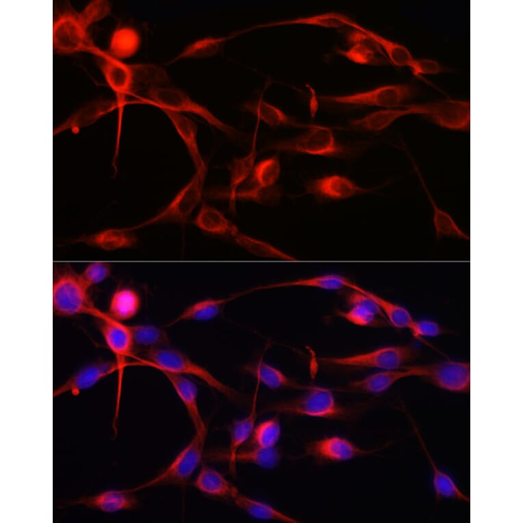 Immunofluorescence - Anti-Calmodulin 1 + Calmodulin 2 + Calmodulin 3 Antibody (A91947) - Antibodies.com