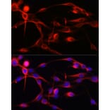 Immunofluorescence - Anti-Calmodulin 1 + Calmodulin 2 + Calmodulin 3 Antibody (A91947) - Antibodies.com