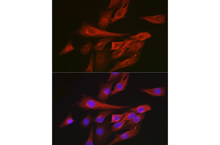 Immunofluorescence - Anti-Calmodulin 1 + Calmodulin 2 + Calmodulin 3 Antibody (A91947) - Antibodies.com