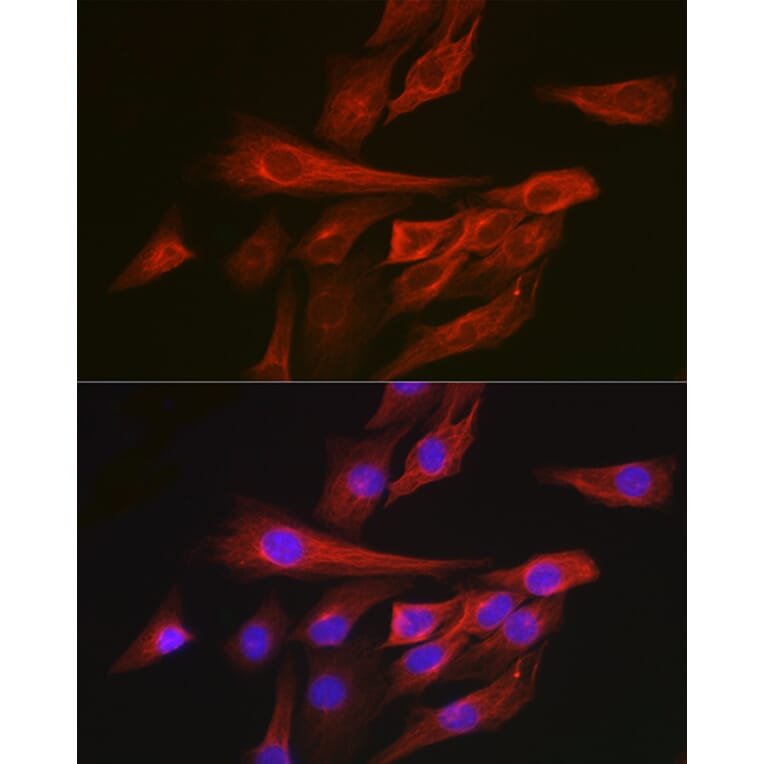 Immunofluorescence - Anti-Calmodulin 1 + Calmodulin 2 + Calmodulin 3 Antibody (A91947) - Antibodies.com