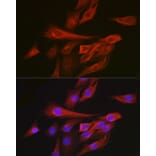 Immunofluorescence - Anti-Calmodulin 1 + Calmodulin 2 + Calmodulin 3 Antibody (A91947) - Antibodies.com