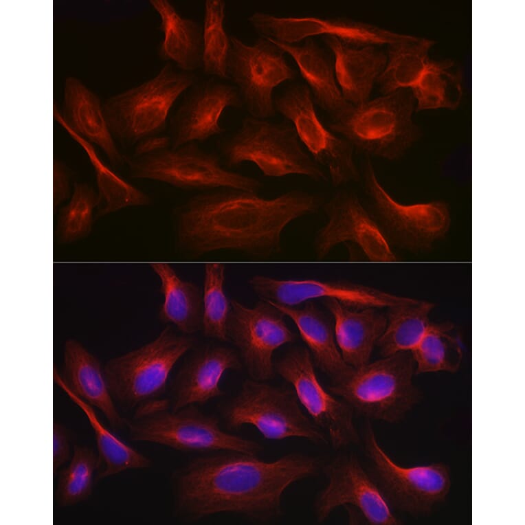 Immunofluorescence - Anti-Calmodulin 1 + Calmodulin 2 + Calmodulin 3 Antibody (A91947) - Antibodies.com