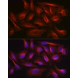 Immunofluorescence - Anti-Calmodulin 1 + Calmodulin 2 + Calmodulin 3 Antibody (A91947) - Antibodies.com