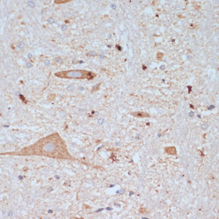 Immunohistochemistry - Anti-VAChT Antibody (A91949) - Antibodies.com