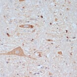 Immunohistochemistry - Anti-VAChT Antibody (A91949) - Antibodies.com