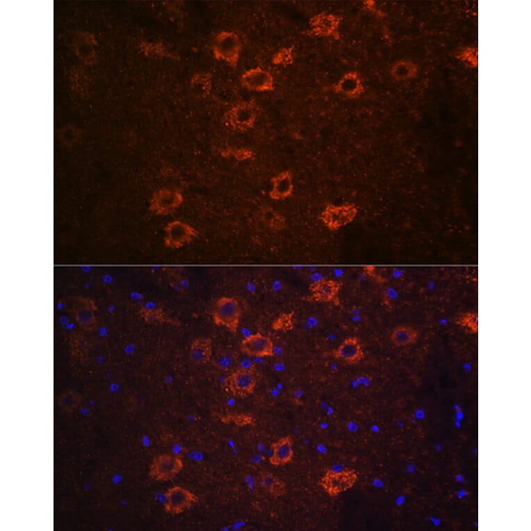Immunofluorescence - Anti-VAChT Antibody (A91949) - Antibodies.com