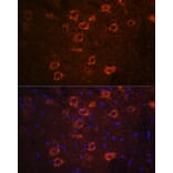 Immunofluorescence - Anti-VAChT Antibody (A91949) - Antibodies.com