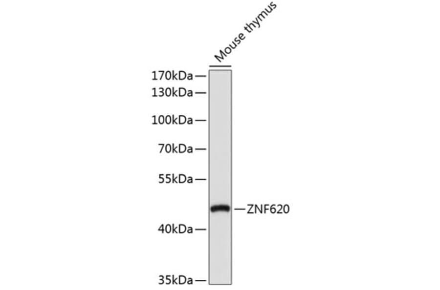 Western Blot - Anti-ZNF620 Antibody (A91951) - Antibodies.com