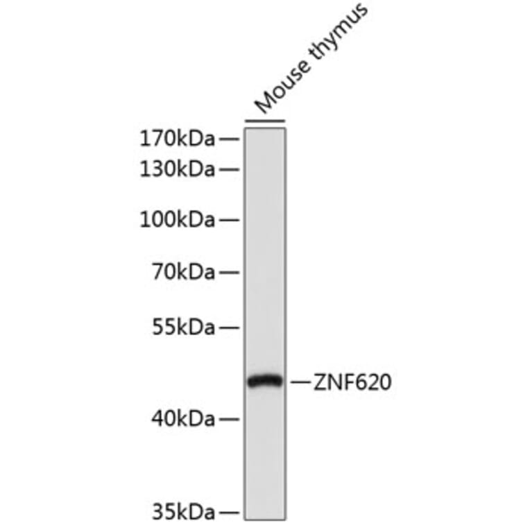 Western Blot - Anti-ZNF620 Antibody (A91951) - Antibodies.com