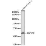 Western Blot - Anti-ZNF620 Antibody (A91951) - Antibodies.com