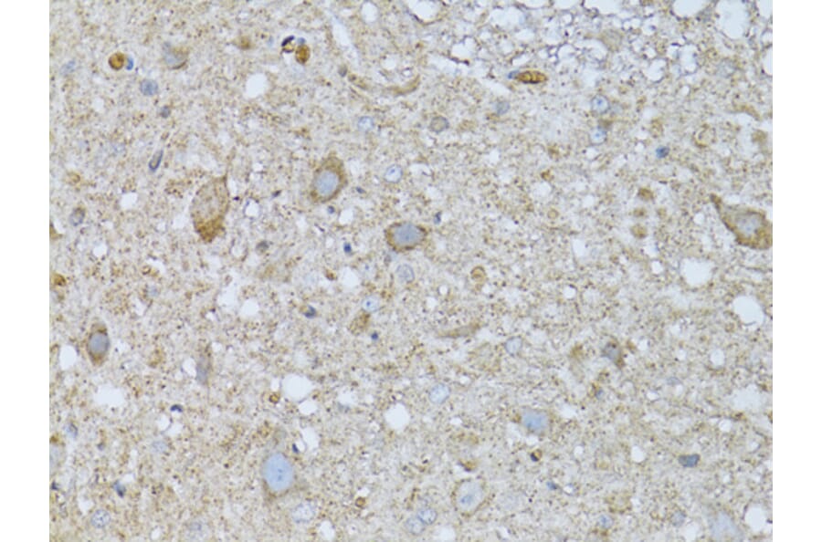 Immunohistochemistry - Anti-PHLDA2 Antibody (A13924) - Antibodies.com