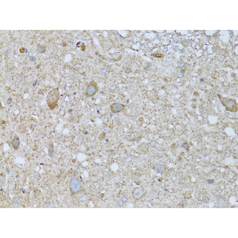 Immunohistochemistry - Anti-PHLDA2 Antibody (A13924) - Antibodies.com