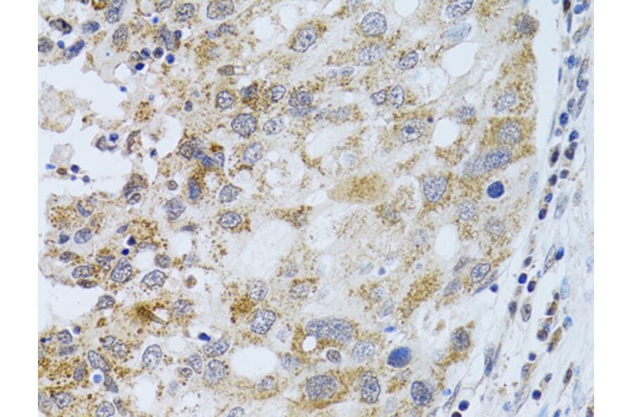 Immunohistochemistry - Anti-PHLDA2 Antibody (A13924) - Antibodies.com