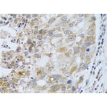 Immunohistochemistry - Anti-PHLDA2 Antibody (A13924) - Antibodies.com