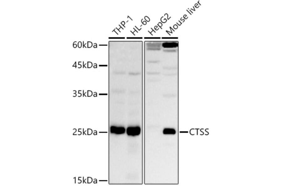 Western Blot - Anti-Cathepsin S Antibody (A91954) - Antibodies.com