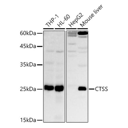 Western Blot - Anti-Cathepsin S Antibody (A91954) - Antibodies.com