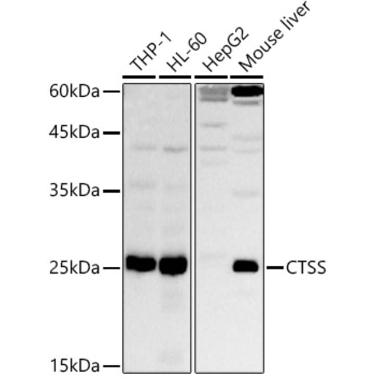 Western Blot - Anti-Cathepsin S Antibody (A91954) - Antibodies.com