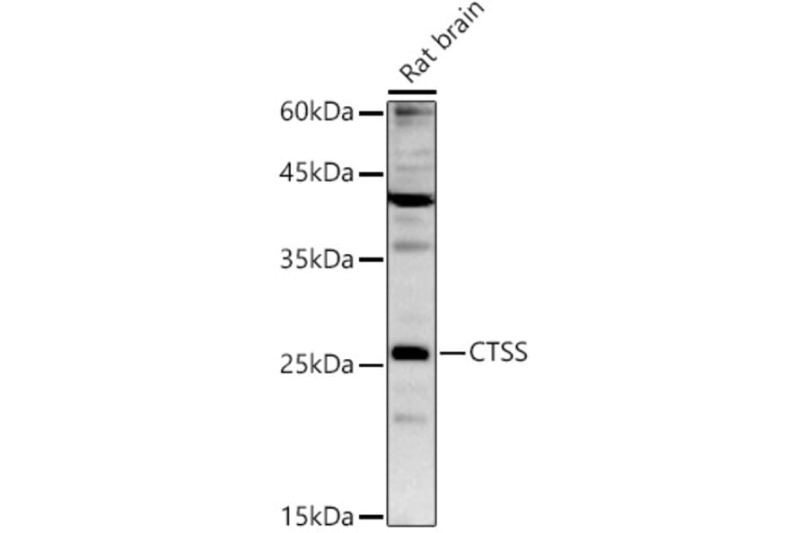 Western Blot - Anti-Cathepsin S Antibody (A91954) - Antibodies.com