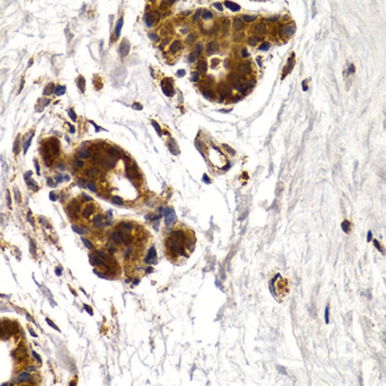 Immunohistochemistry - Anti-Cathepsin S Antibody (A91954) - Antibodies.com
