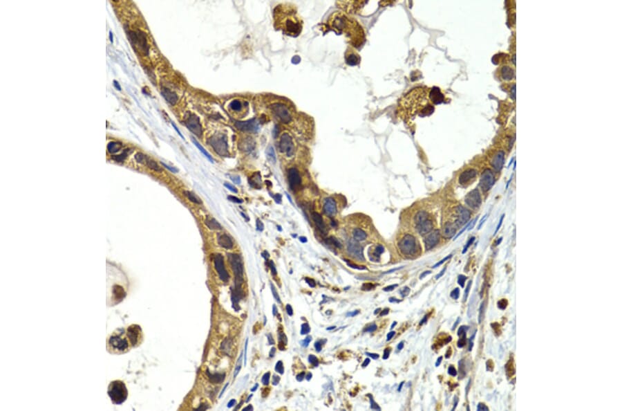 Immunohistochemistry - Anti-Cathepsin S Antibody (A91954) - Antibodies.com