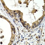 Immunohistochemistry - Anti-Cathepsin S Antibody (A91954) - Antibodies.com