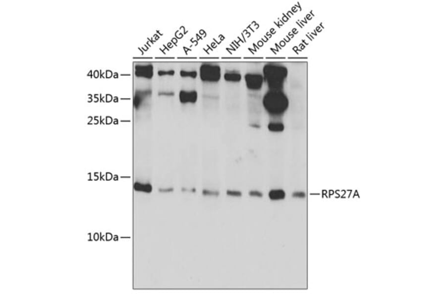 Western Blot - Anti-Ubiquitin Antibody (A91956) - Antibodies.com