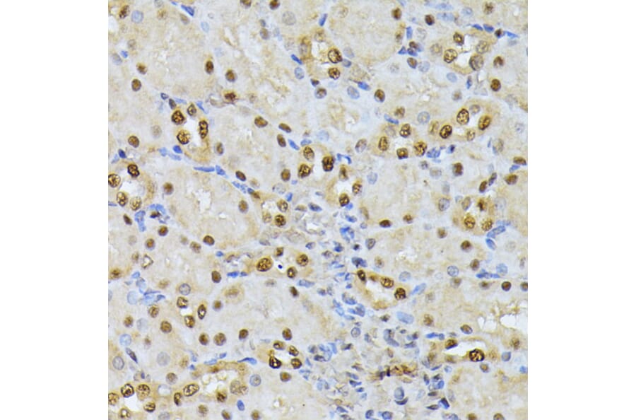 Immunohistochemistry - Anti-Ubiquitin Antibody (A91956) - Antibodies.com