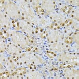 Immunohistochemistry - Anti-Ubiquitin Antibody (A91956) - Antibodies.com