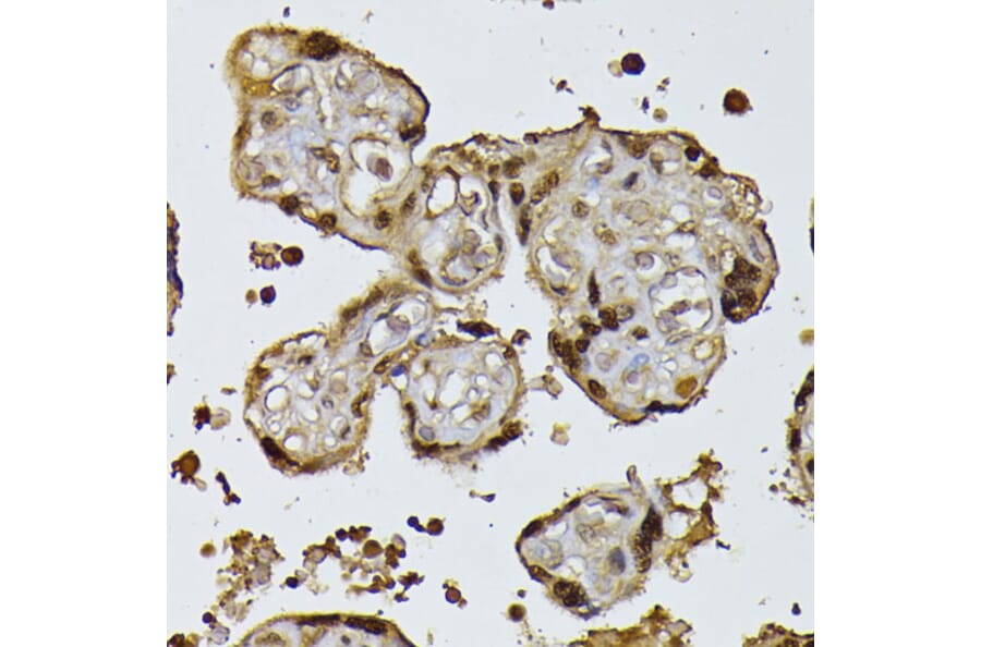 Immunohistochemistry - Anti-Ubiquitin Antibody (A91956) - Antibodies.com