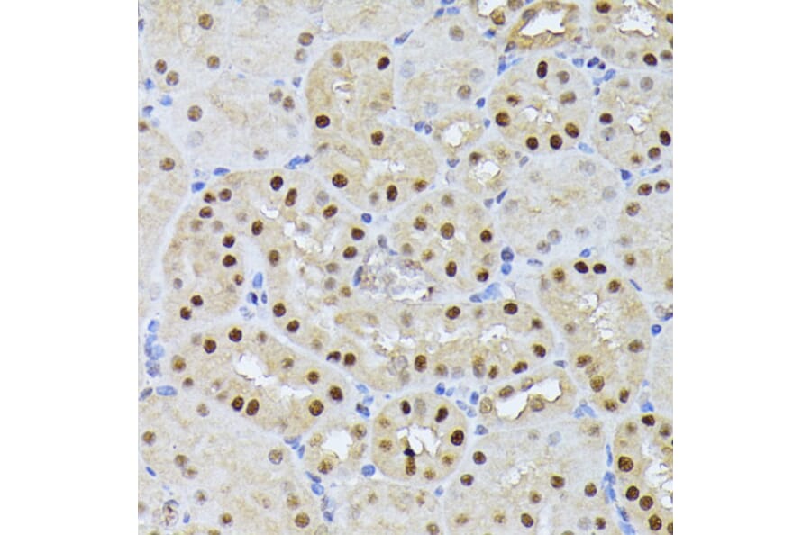 Immunohistochemistry - Anti-Ubiquitin Antibody (A91956) - Antibodies.com